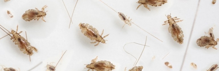 The Life of Head Lice: From Egg Adult Everything In-between | Lice